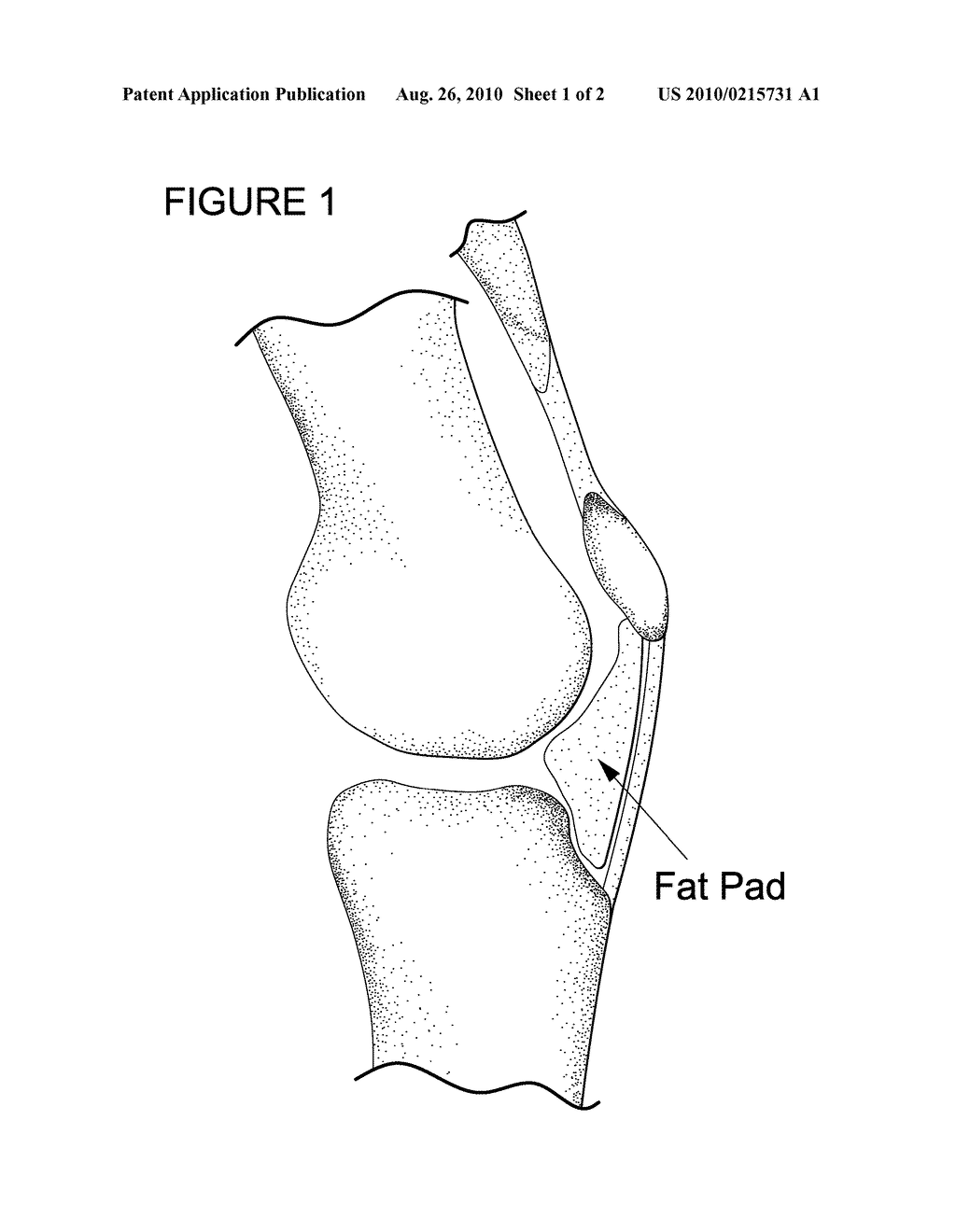 METHOD FOR IMPROVING CARTILAGE REPAIR AND/OR PREVENTING CARTILAGE DEGENERATION IN A JOINT - diagram, schematic, and image 02