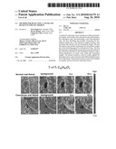 Method for detecting cancer and reagents for use therein diagram and image