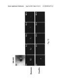 Method for detecting cancer and reagents for use therein diagram and image