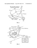 SYSTEM FOR DETERMINING PERFORMANCE CHARACTERISTICS OF A GOLF SWING diagram and image