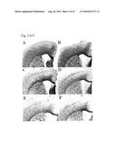 METHOD OFTREATING DEMYELINATION DISEASES diagram and image