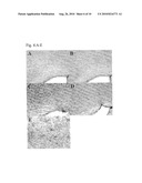 METHOD OFTREATING DEMYELINATION DISEASES diagram and image