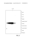 Sodium-independent transporter carrying acidic amino acid and its gene diagram and image