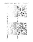 Sodium-independent transporter carrying acidic amino acid and its gene diagram and image