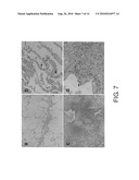 THERAPEUTIC AGENT FOR INTERSTITIAL PULMONARY DISEASE COMPRISING ANTI-HMGB-1 ANTIBODY diagram and image