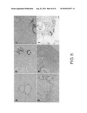 THERAPEUTIC AGENT FOR INTERSTITIAL PULMONARY DISEASE COMPRISING ANTI-HMGB-1 ANTIBODY diagram and image