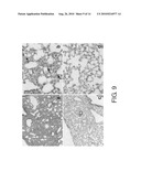 THERAPEUTIC AGENT FOR INTERSTITIAL PULMONARY DISEASE COMPRISING ANTI-HMGB-1 ANTIBODY diagram and image