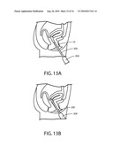 APPARATUS, METHOD AND SYSTEM FOR DETERMINING A PHYSIOLOGICAL CONDITION WITHIN A MAMMAL diagram and image