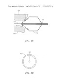 Assessment Of Aortic Heart Valve To Facilitate Repair Or Replacement diagram and image