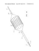 Assessment Of Aortic Heart Valve To Facilitate Repair Or Replacement diagram and image