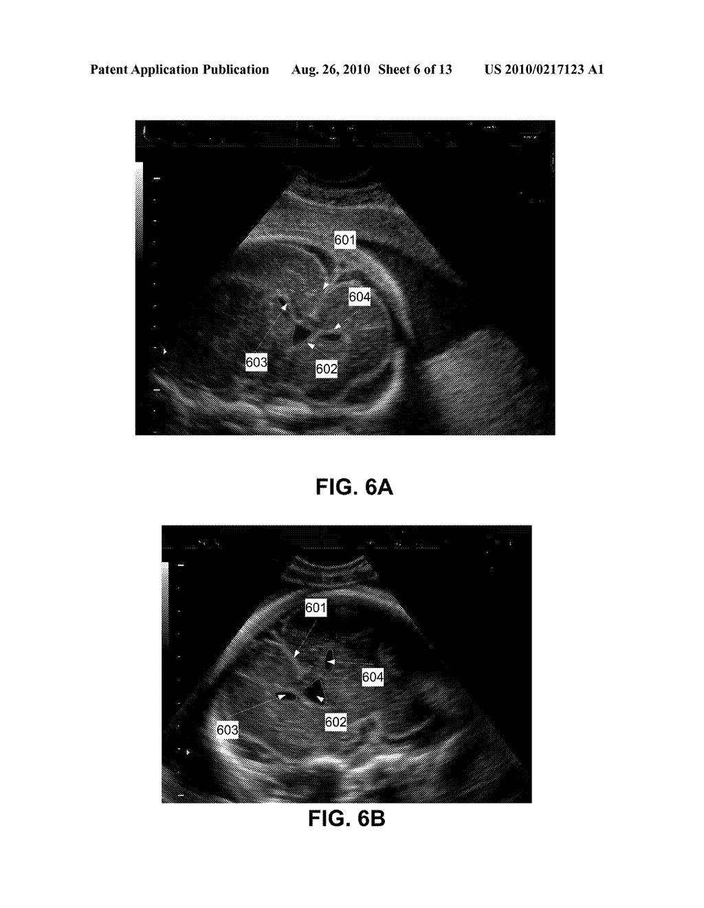 METHODS AND SYSTEMS OF MANAGING ULTRASONOGRAPHIC DIAGNOSIS - diagram, schematic, and image 07