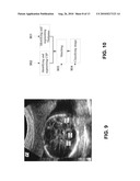 METHODS AND SYSTEMS OF MANAGING ULTRASONOGRAPHIC DIAGNOSIS diagram and image