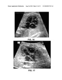 METHODS AND SYSTEMS OF MANAGING ULTRASONOGRAPHIC DIAGNOSIS diagram and image