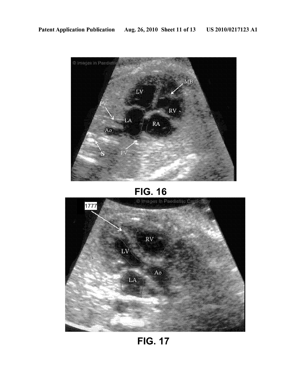 METHODS AND SYSTEMS OF MANAGING ULTRASONOGRAPHIC DIAGNOSIS - diagram, schematic, and image 12