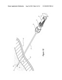 VALVED CONNECTOR diagram and image