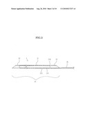 INTRAVASCULAR FOREIGN MATTER SUCTION ASSEMBLY diagram and image