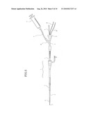 INTRAVASCULAR FOREIGN MATTER SUCTION ASSEMBLY diagram and image