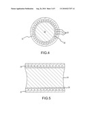 MEDICAL DEVICE HAVING LAMINATE-COATED BRAID ASSEMBLY diagram and image