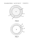 MEDICAL DEVICE HAVING LAMINATE-COATED BRAID ASSEMBLY diagram and image