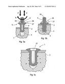 IMPLANT, IMPLANTATION TOOL, KIT AND METHOD diagram and image