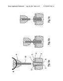 IMPLANT, IMPLANTATION TOOL, KIT AND METHOD diagram and image