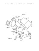 REAL-TIME SURGICAL REFERENCE INDICIUM APPARATUS AND METHODS FOR INTRAOCULAR LENS IMPLANTATION diagram and image