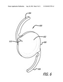 REAL-TIME SURGICAL REFERENCE INDICIUM APPARATUS AND METHODS FOR INTRAOCULAR LENS IMPLANTATION diagram and image