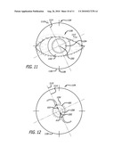 REAL-TIME SURGICAL REFERENCE INDICIUM APPARATUS AND METHODS FOR INTRAOCULAR LENS IMPLANTATION diagram and image