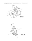 REAL-TIME SURGICAL REFERENCE INDICIUM APPARATUS AND METHODS FOR INTRAOCULAR LENS IMPLANTATION diagram and image