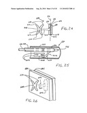 Transesophageal gastric reduction method and device for practicing same diagram and image