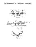 Transesophageal gastric reduction method and device for practicing same diagram and image