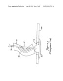 PLUG FOR ARTERIOTOMY CLOSURE AND METHOD OF USE diagram and image