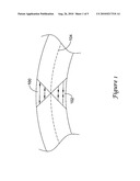 MODIFIED PLUG FOR ARTERIOTOMY CLOSURE diagram and image