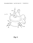 Method of Treating A Degenerate Spinal Segment diagram and image