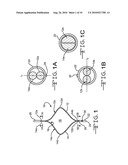 LOW PROFILE SUPPORT FRAME AND RELATED INTRALUMINAL MEDICAL DEVICES diagram and image