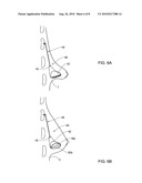 SYSTEM AND METHOD FOR RESHAPING SOFT TISSUE diagram and image