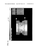 SCANNING DENTAL MODELS diagram and image