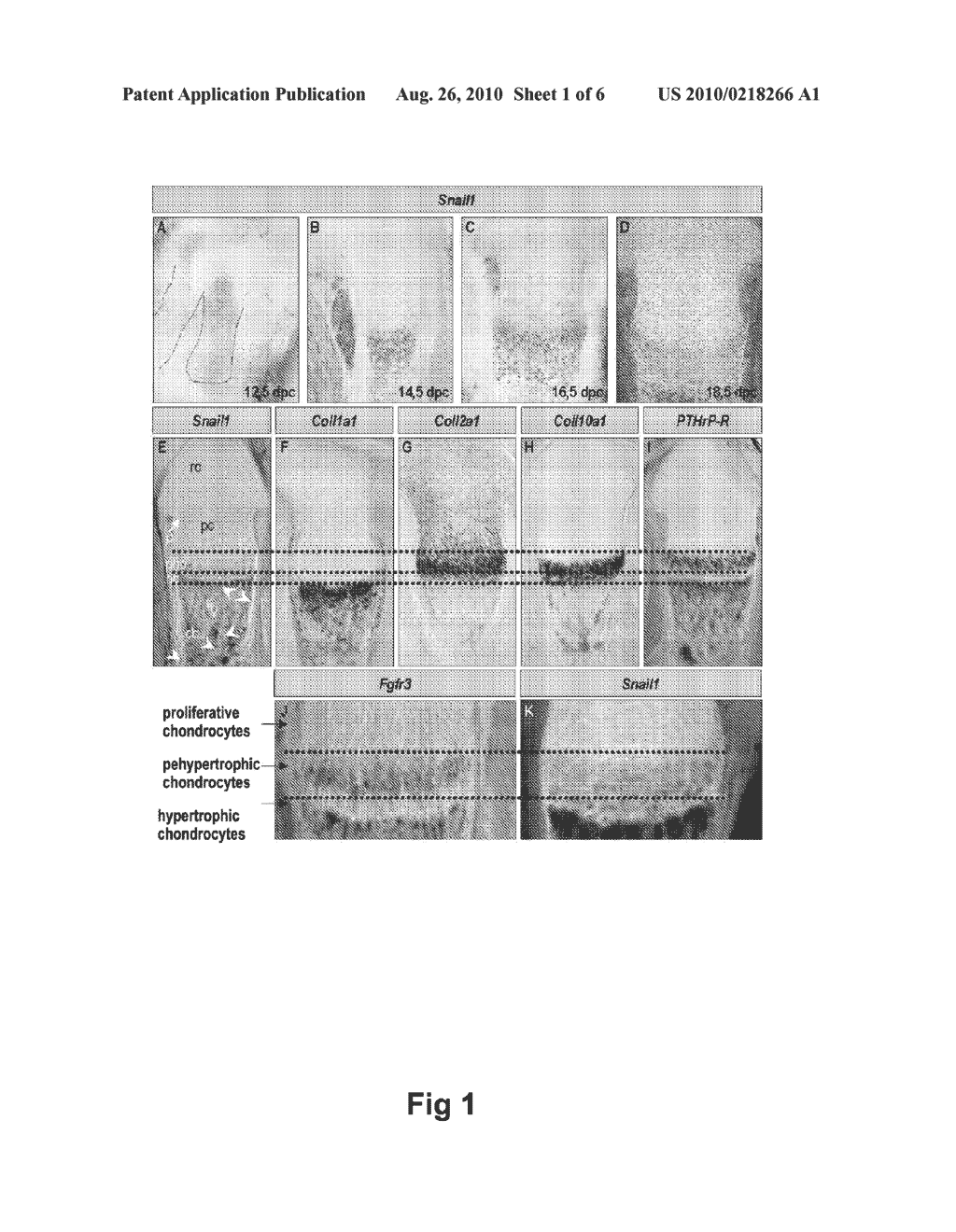 METHODS OF IDENTIFYING AND USING SNAIL1 INHIBITORY COMPOUNDS IN CHONDRODYSPLASIA TREATMENT AND PREPARATION OF PHARMACEUTICAL COMPOSITIONS - diagram, schematic, and image 02