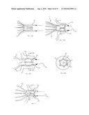 Two-Part Package for Medical Implant diagram and image