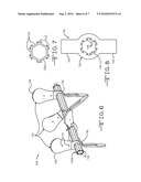 AGITATION SYSTEM FOR BLOWING WOOL MACHINE diagram and image