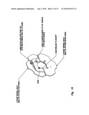 Bale processing apparatus diagram and image