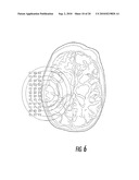 Atomic Magnetometer Sensor Array Magnetoencephalogram Systems and Methods diagram and image