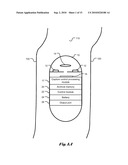 Capture Control for in vivo Camera diagram and image