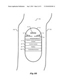 Capture Control for in vivo Camera diagram and image