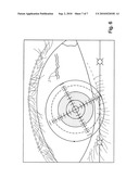 Eye registration system for refractive surgery and associated methods diagram and image