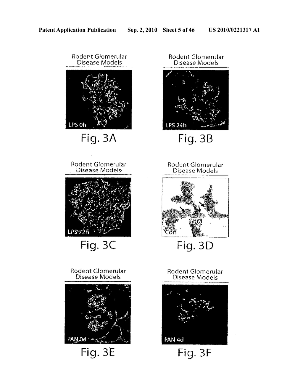 DYNAMIN MEDIATED DISEASES AND ASSOCIATED METHODS AND PRODUCTS - diagram, schematic, and image 06