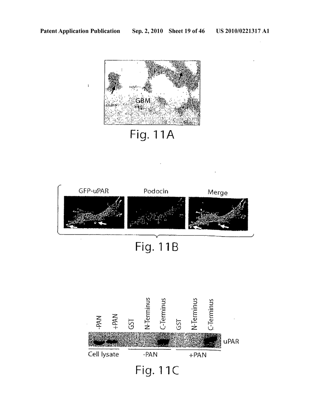 DYNAMIN MEDIATED DISEASES AND ASSOCIATED METHODS AND PRODUCTS - diagram, schematic, and image 20