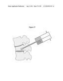 ENHANCING SOLUTE TRANSPORT WITHIN A TISSUE SCAFFOLD diagram and image