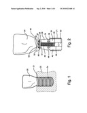 Screw, head-lock, to abutment of dental implant body diagram and image