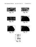 PATCHED POLYPEPTIDES AND USES RELATED THERETO diagram and image